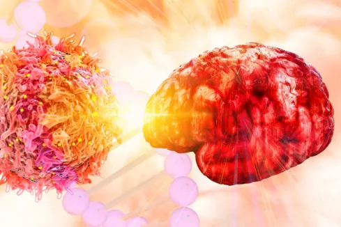 Persona con esclerosis tomando CBD